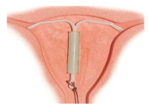 ��ԭ�ϭh(hu��n)ȡ�h(hu��n)ԭ��,�ϭh(hu��n)ȡ�h(hu��n)�z��,�ϭh(hu��n)ȡ�h(hu��n)�ί�,