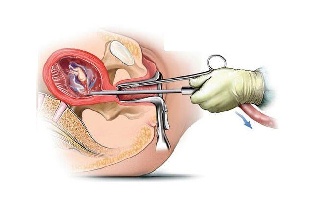 ��ԭ�����֏�(f��),�oʹ�����z��,�oʹ�����ί�,